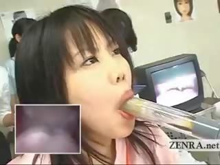 Japan betje eje expert uses plastikden sik with camera for agzyna bermek ekzamen